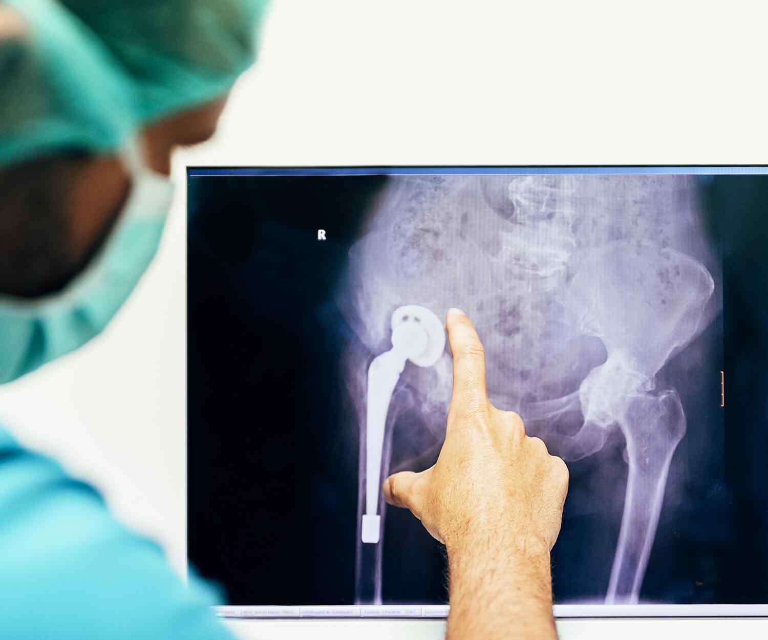 https://www.asemhairtransplant.com/wp-content/uploads/2021/08/card_image_05.jpg