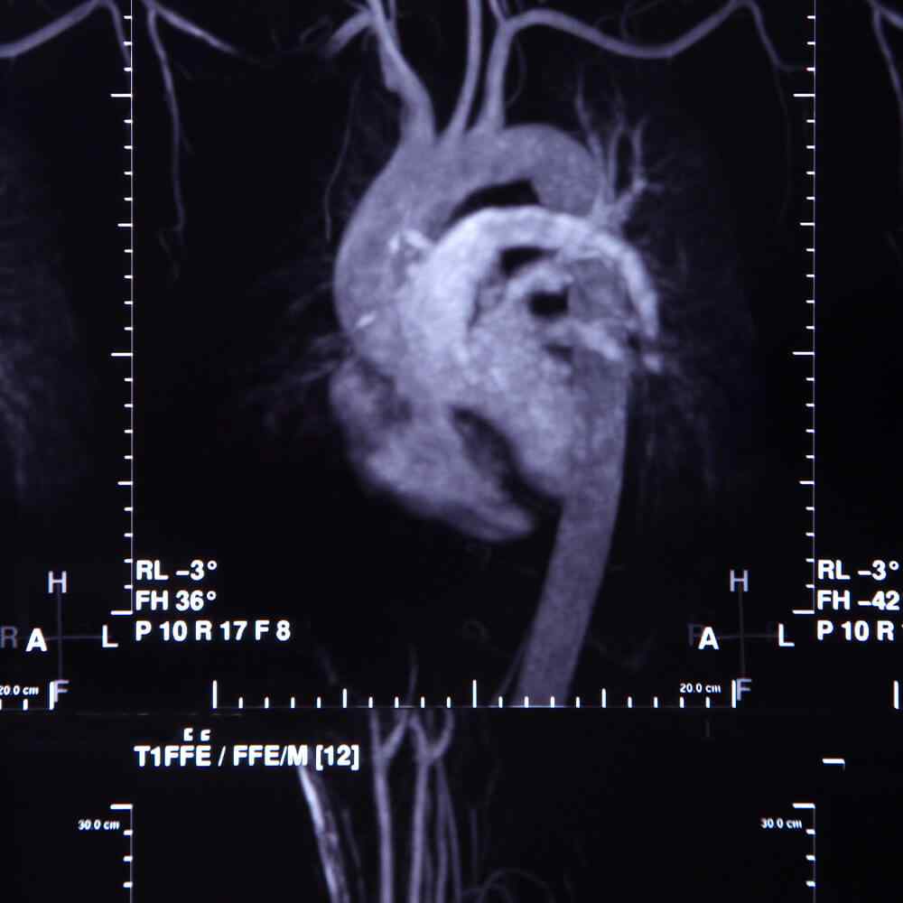 inner_image_05 https://www.asemhairtransplant.com/wp-content/uploads/2021/08/inner_image_05.jpg