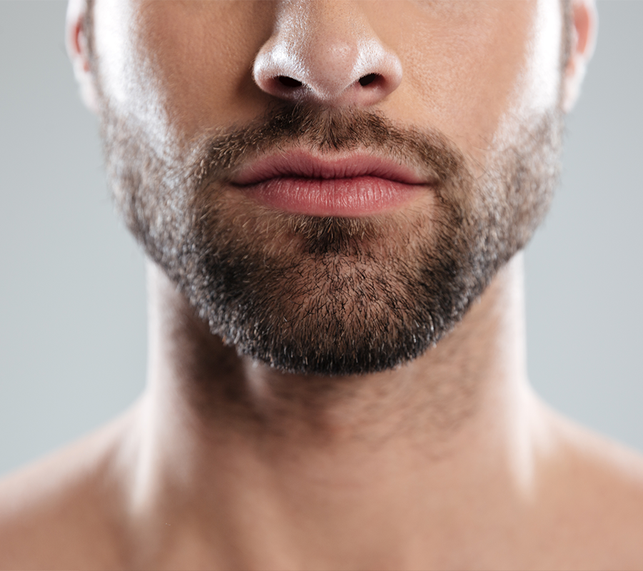 https://www.asemhairtransplant.com/wp-content/uploads/2025/04/biyik-ve-sakal-ekimi_446-509.png